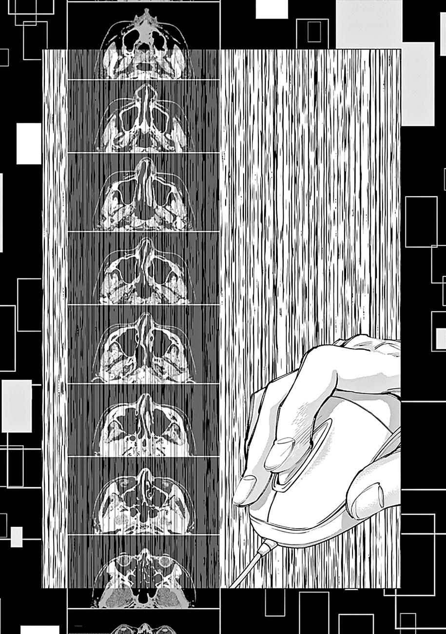 Radiation House Scan 35 9